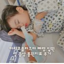 마이코플라즈마 폐렴 입원 기간 열 증상 통원치료 후기