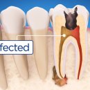 광주플란트치과의원 이미지