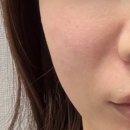 뉴유명약국 | 팔자주름크림 효과 본 후기 전후사진ㅣ 레티놀 다이소 vs 약국템