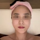 방배동피부관리 명품에스테틱 이수점 오투덤산소테라피 후기