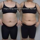 슬림 앤 벌크 | 강변 구의 피부관리 체형별로 알아보는 다이어트 솔루션