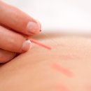 조종 한의원 이미지