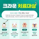 서귀포치과기공소 이미지