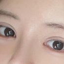 아이그램성형외과 이미지