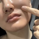 30대피부관리 팔자주름탄력관리 정담아에스테틱에서 팔자필러 대신 더파민 관리 내돈내산 후기