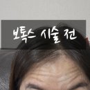 순천365여성의원 | &#34;내돈내산&#34; 순천 보톡스의 메카 365여성의원!