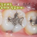 청아치과기공소 이미지