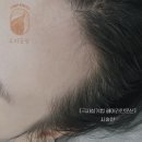 두피공방헤어라인