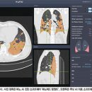 수메디&테크 매경이코노미
