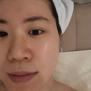부산하단피부관리 하단피부관리실 어스제이스킨클리닉 필링 후기