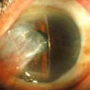 연세진안과 이미지