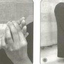 Hypermobility(과운동성) 이미지