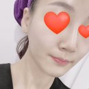 앨리톡스 | 노원역 피부관리, 웨딩관리 더샵뷰티
