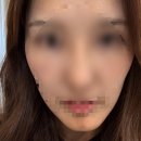 에미뜨의원 네이버블로그