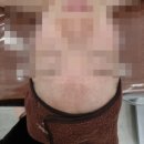 새아뷰티 | 김해 외동-웨딩관리, 새아뷰티피부관리 후기