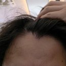 모모살롱 - 제주시 남광로2길 17 | [광교미용실] 빗자루 모발 심폐소생! 데미 클리닉 찐감동 리뷰 (광교 모모살롱)