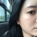 강남 스킨부스터 수부지 속건조 관리 후기 3일차