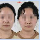바른 자세교정 및 셀프 수기요법 | [대구체형교정] 수성구 바른 얼굴 바른 몸 체형교정원 두개안면 &amp; 체형조정 후기