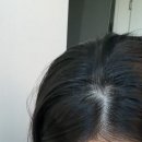 그로우 - 송파구 송파대로 345 | 내돈내산 오니스트 케라그로우 후기; 모낭염 여드름피부의 비오틴