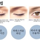 히트성형외과의원 이미지