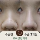 로이성형외과의원 이미지