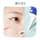 수술 후 흉터 관리 메디폼 스카겔 사용 후기