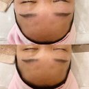 예쁠래에스테틱 | 광주 피부관리 양산동 &#34;예쁠래에스테틱&#34;에서 꿀 피부 만들기 쉬워요