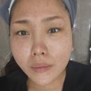 미금메이퓨어의원 네이버블로그