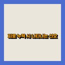 신호 이미지
