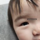 [도콩+508] 16개월 아기 누네조은안과 눈물샘 탐침술 후기 및 경과