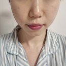 (주)멍이사랑 | [공지] 결혼 끝나고 깨달은 예신 관리 TOP5 | LDM·온다리프팅 솔직후기