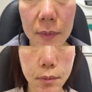 르쏘메의원 이미지