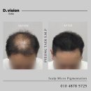 디비전 스칼프 이미지