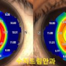 수지드림안과의원 이미지