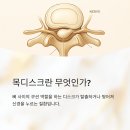 목통증 원인, 통증이 왜 생길까요? 이미지