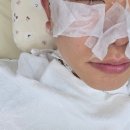 은월테라피 | [평택피부관리] 은월테라피 솔직후기: 눈가 비립종 압출 인생 맛집! 모공 대청소로 매끈해진 피부 변화