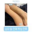 날씨도 시원하고 깨끗한데~ 깨끗왁싱에서 깨끗하게 왁싱 할사람 ! 일산남자왁서 여자왁서 항시 상주하고...