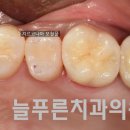 네츄럴치과기공소 이미지