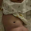 고잔연세소아청소년과의원 | 갑자기 배에 두드러기가 올라온 아기, 늦은 저녁 안산 달빛 어린이 병원 다녀왔어요