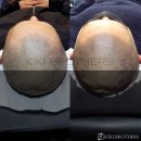 쉬크헤어 이미지