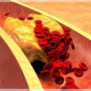 핏피티(Fit PT) 이미지