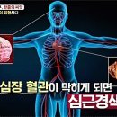 심근경색 초기증상 갑자기 가슴통증, 심장두근거림 있을 때 '의심' 이미지