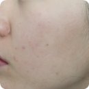 클루시브 | 올리브영 진정크림 AHC 클루시브 어성진정크림 사용후기