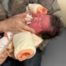 DMC수색신경외과의원 | [신생아 설소대] 수색 신익순소아과 아기 설소대 시술 후기