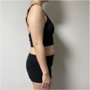 기우 | 지방분해주사 후기 걱정은 기우였어요