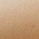 강남뷰베스트의원 이미지