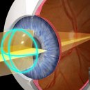 아이프렌드 안경 이미지