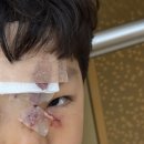 와인성형외과의원 | 대구 중구 닥터지니 성형외과 아이 봉합 수술 전문 강력 추천합니다. (25.6.27-28)
