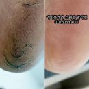 발건강관리사(2급) 이미지