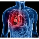 ◇ 폐암과 대장암 &#39;90% 예방법&#39; ◇ 이미지